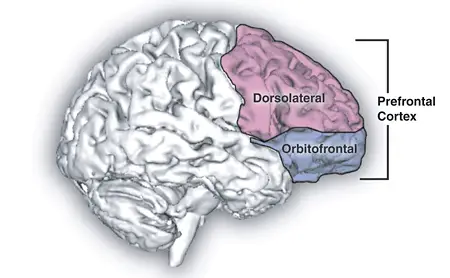 ADHD and Alcohol Alters Prefrontal Cortex